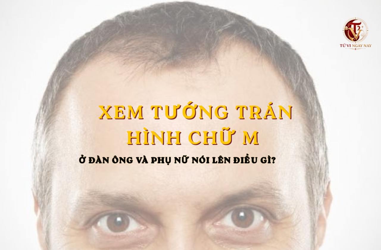 Xem tướng trán hình chữ M ở đàn ông và phụ nữ nói lên điều gì?